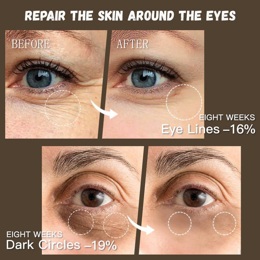 Skin Whitening Retinol Eye Cream - Eva Essentials